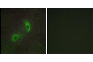 Immunofluorescence analysis of HUVEC cells, using HGS antibody. (HGS 抗体)