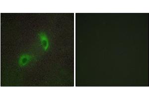 Immunofluorescence analysis of HUVEC cells, using HGS antibody. (HGS 抗体)