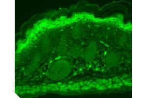 Immunohistochemistry analysis using Mouse Anti-TrpV3 Monoclonal Antibody, Clone S15-4 . (TRPV3 抗体  (AA 774-791) (PerCP))