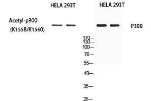 Western Blot (WB) analysis of HeLa 293T using EP300 antibody. (p300 抗体)