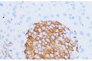 Immunohistochemistry of paraffin-embedded Mouse pancreas using NOTCH3 Polyclonal Antibody at dilution of 1:100 (40x lens). (NOTCH3 抗体)