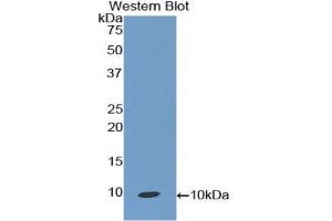 Western blot analysis of the recombinant protein. (CCL19 抗体  (AA 32-103))