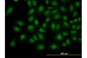 Immunofluorescence of monoclonal antibody to TRIB3 on HeLa cell. (TRIB3 抗体  (AA 56-145))