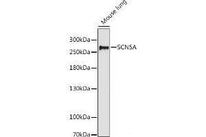 Western blot analysis of extracts of Mouse lung using SCN5A Polyclonal Antibody at dilution of 1:1000. (SCN5A 抗体)