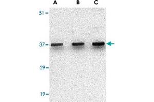Western blot analysis of UNG in C2C12 cell lysate with UNG polyclonal antibody  at (A) 0. (UNG 抗体  (C-Term))