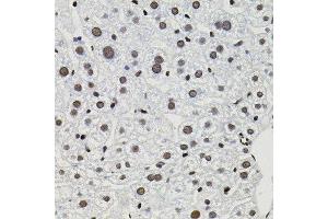 Immunohistochemistry of paraffin-embedded mouse liver using GTF2I antibody. (GTF2I 抗体)