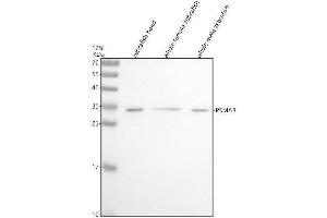 Western blot analysis of PSMA3 using anti-PSMA3 antibody (AZQ4V918).