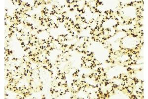 ABIN6278679 at 1/100 staining Mouse lung tissue by IHC-P. (CDKL5 抗体  (Internal Region))