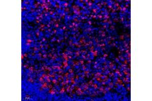 Immunofluorescence of paraffin embedded mouse lymph node using SLBP (ABIN7075733) at dilution of 1: 650 (400x lens) (SLBP 抗体)