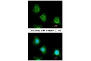 ICC/IF Image Immunofluorescence analysis of methanol-fixed HeLa, using PF4V1, antibody at 1:200 dilution.