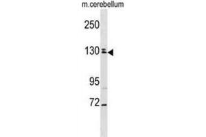 Western Blotting (WB) image for anti-TBC1 Domain Family, Member 8 (With GRAM Domain) (TBC1D8) antibody (ABIN2999068) (TBC1D8 抗体)