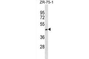 Western Blotting (WB) image for anti-ST6 (Alpha-N-Acetyl-Neuraminyl-2,3-beta-Galactosyl-1,3)-N-Acetylgalactosaminide alpha-2,6-Sialyltransferase 5 (ST6GALNAC5) antibody (ABIN3000960) (ST6GALNAC5 抗体)
