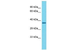 Host:  Rabbit  Target Name:  Tcea2  Sample Type:  Rat Spleen lysates  Antibody Dilution:  1. (TCEA2 抗体  (Middle Region))