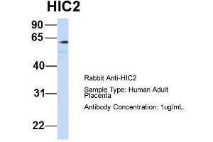 Host:  Rabbit  Target Name:  HIC2  Sample Type:  Human Adult Placenta  Antibody Dilution:  1. (HIC2 抗体  (Middle Region))