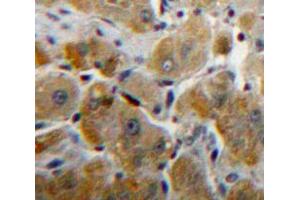 IHC-P analysis of Liver tissue, with DAB staining. (Fibrinogen beta Chain 抗体  (AA 45-491))