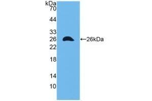 Detection of Recombinant CX43, Mouse using Polyclonal Antibody to Connexin 43 (CX43) (Connexin 43/GJA1 抗体  (AA 180-382))