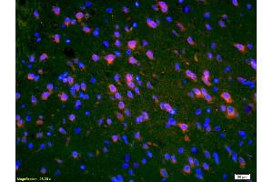 Formalin-fixed and paraffin-embedded rat brain labeled with Anti-PMP2 Polyclonal Antibody, Unconjugated (ABIN676823) 1:200, overnight at 4°C, The secondary antibody was Goat Anti-Rabbit IgG, Cy3 conjugated used at 1:200 dilution for 40 minutes at 37°C. (PMP2 抗体  (AA 31-132))
