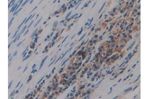 DAB staining on IHC-P;;Samples: Human Lung Tissue (Preprovasopressin (AA 21-164) 抗体)