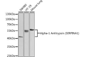 Western blot analysis of extracts of various cell lines, using Alpha-1 Antitrypsin (Alpha-1 Antitrypsin (SERPIN)) antibody (2481) at 1:1000 dilution. (SERPINA1 抗体  (AA 25-315))