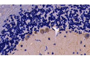 Detection of TNFa in Rat Cerebellum Tissue using Polyclonal Antibody to Tumor Necrosis Factor Alpha (TNFa) (TNF alpha 抗体  (AA 80-235))