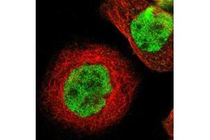 Immunofluorescent staining of A-431 cells with ZBTB7B polyclonal antibody  (Green) shows positivity in nucleus but excluded from the nucleoli. (ZBTB7B 抗体)