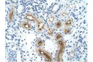 GGTLA4 antibody was used for immunohistochemistry at a concentration of 4-8 ug/ml to stain Epithelial cells of renal tubule (arrows) in Human Kidney.