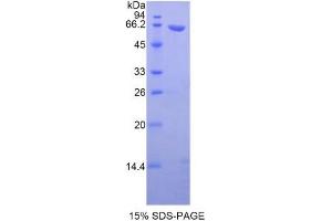 SDS-PAGE (SDS) image for Wingless-Type MMTV Integration Site Family, Member 5A (WNT5A) ELISA Kit (ABIN6574332)