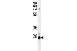 Western Blotting (WB) image for anti-Interleukin 17B (IL17B) (AA 39-66) antibody (ABIN3031458)