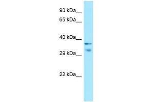 WB Suggested Anti-MRGPRX1 Antibody Titration: 1. (MRGPRX1 抗体  (C-Term))