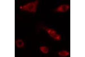 ABIN6274161 staining HepG2 cells by IF/ICC. (POLA1 抗体  (N-Term))