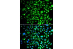 Immunofluorescence analysis of A549 cells using PTK6 antibody. (PTK6 抗体  (AA 222-451))