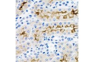 Immunohistochemical analysis of IRSp53 staining in rat kidney formalin fixed paraffin embedded tissue section. (BAIAP2 抗体)