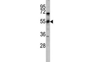 Western blot analysis of CD36 antibody and CEM lysate. (CD36 抗体  (AA 213-242))