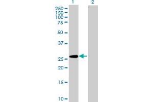 Western Blotting (WB) image for anti-Platelet-Activating Factor Acetylhydrolase 1b, Catalytic Subunit 3 (29kDa) (PAFAH1B3) (AA 1-231) antibody (ABIN518589)