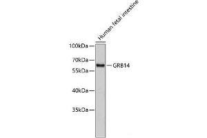 Western blot analysis of extracts of Human fetal intestine using GRB14 Polyclonal Antibody. (GRB14 抗体)