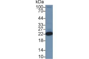 Detection of PARK7 in Rat Heart lysate using Polyclonal Antibody to Parkinson Disease Protein 7 (PARK7) (PARK7/DJ1 抗体  (AA 1-189))