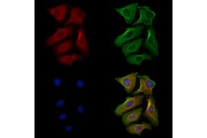 Phospho-Phospholamban (Ser16) Antibody staining Hela cells(heat shock treatment) by IF/ICC. (Phospholamban 抗体  (pSer16))