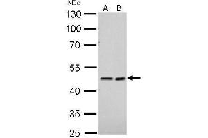 WB Image NDRG1 antibody detects NDRG1 protein by Western blot analysis. (NDRG1 抗体)