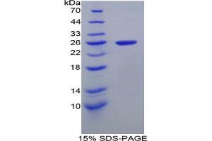 SDS-PAGE analysis of Rat Intercellular Adhesion Molecule 4 Protein.