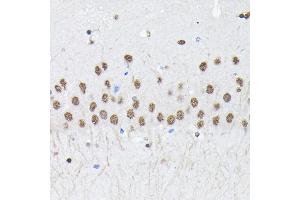 Immunohistochemistry of paraffin-embedded mouse brain using PTBP2 Rabbit pAb (ABIN6128372, ABIN6146373, ABIN6146374 and ABIN6221684) at dilution of 1:100 (40x lens). (PTBP2 抗体  (AA 1-280))