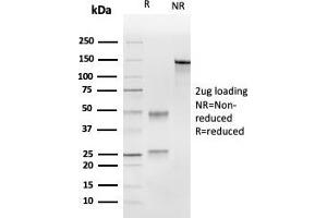SDS-PAGE Analysis Purified UBE2C Mouse Monoclonal Antibody (CPTC-UBE2C-1). (UBE2C 抗体)