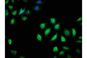 Immunofluorescence staining of A549 cells with ABIN7154600 at 1:166, counter-stained with DAPI. (RIT2 抗体  (AA 1-150))