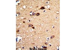 Immunohistochemistry (IHC) image for anti-Unc-5 Homolog C (C. Elegans) (Unc5c) antibody (ABIN3002880) (Unc5c 抗体)