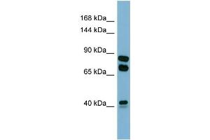 Host:  Rabbit  Target Name:  PXDN  Sample Type:  COLO205 Whole cell lysates  Antibody Dilution:  1. (Peroxidasin 抗体  (N-Term))