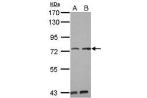 Image no. 2 for anti-Pumilio RNA Binding Family Member 3 (PUM3) (AA 415-648) antibody (ABIN1499029) (KIAA0020 抗体  (AA 415-648))