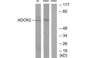 Western blot analysis of extracts from Jurkat cells and K562 cells, using ADCK2 antibody. (ADCK2 抗体)