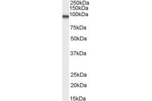 Western Blotting (WB) image for anti-Ankyrin Repeat Domain 18B (ANKRD18B) (C-Term) antibody (ABIN2791452) (ANKRD18B 抗体  (C-Term))