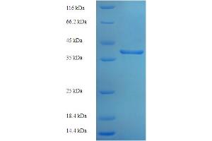 SDS-PAGE (SDS) image for Interferon alpha/beta Receptor 2 (IFNAR2) (AA 27-243) protein (His-SUMO Tag) (ABIN5709721)