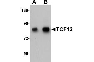 Western Blotting (WB) image for anti-Transcription Factor 12 (TCF12) (N-Term) antibody (ABIN1031604) (TCF12 抗体  (N-Term))