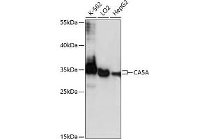 Western blot analysis of extracts of various cell lines, using CA antibody (ABIN7266071) at 1:1000 dilution. (CA5A 抗体  (AA 39-305))